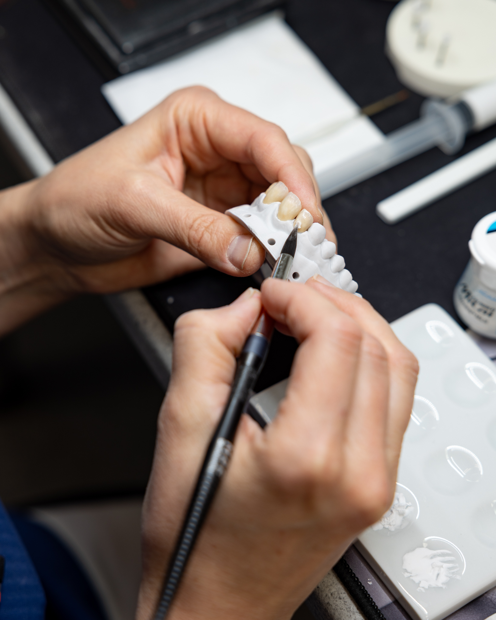 keraamisen kruunu kerrostus