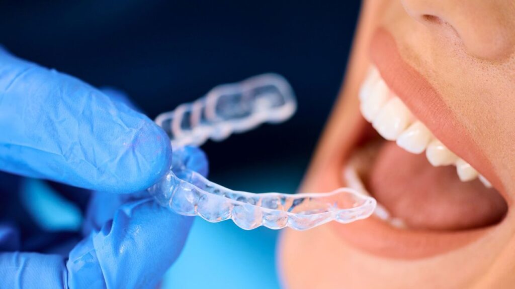Mikä on Invisalign-oikomishoito?